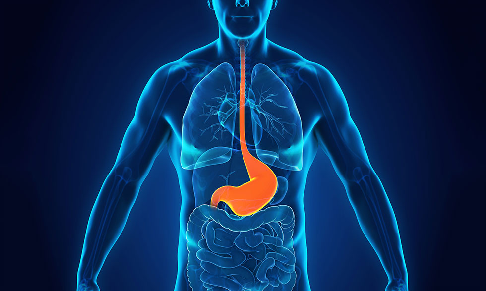 Gastroesophageal Reflux Disease (GERD)